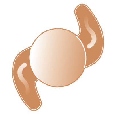 LIO Ufold Intraocular Asférica