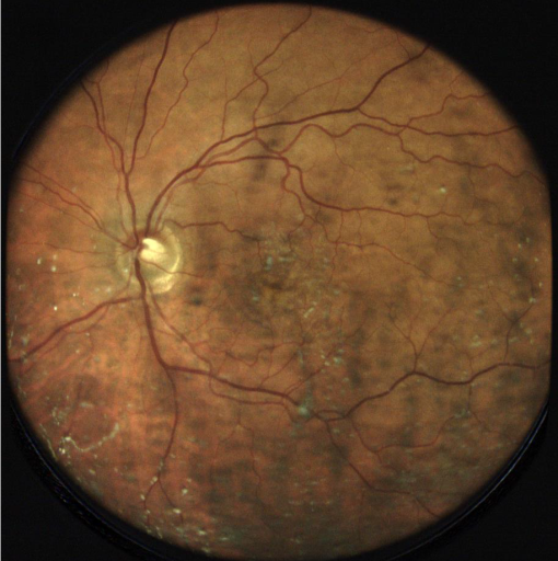Cámara Retinal No Midriática Eidon FA - Imagen 5