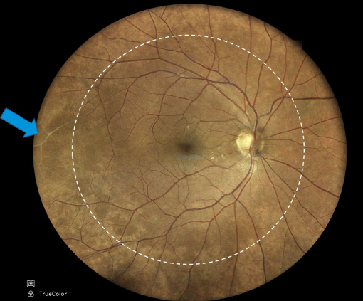 Cámara Retinal No Midriática Eidon FA - Imagen 3
